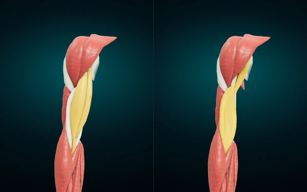 Two views of the right arm. Left: biceps brachii in amber. Right: biceps hidden, showing brachialis and coracobrachialis in amber underneath it
