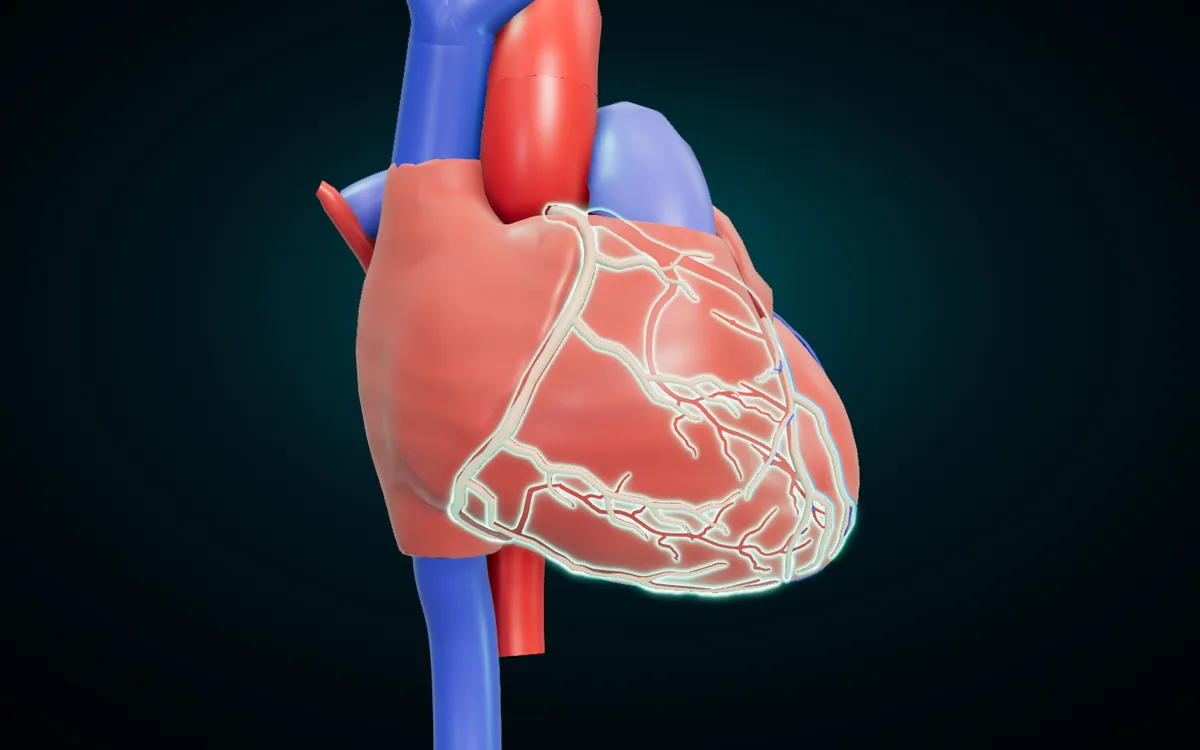 The coronary arteries highlighted on the front of the heart: the right coronary artery in the groove on the right and the anterior interventricular artery running down toward the apex
