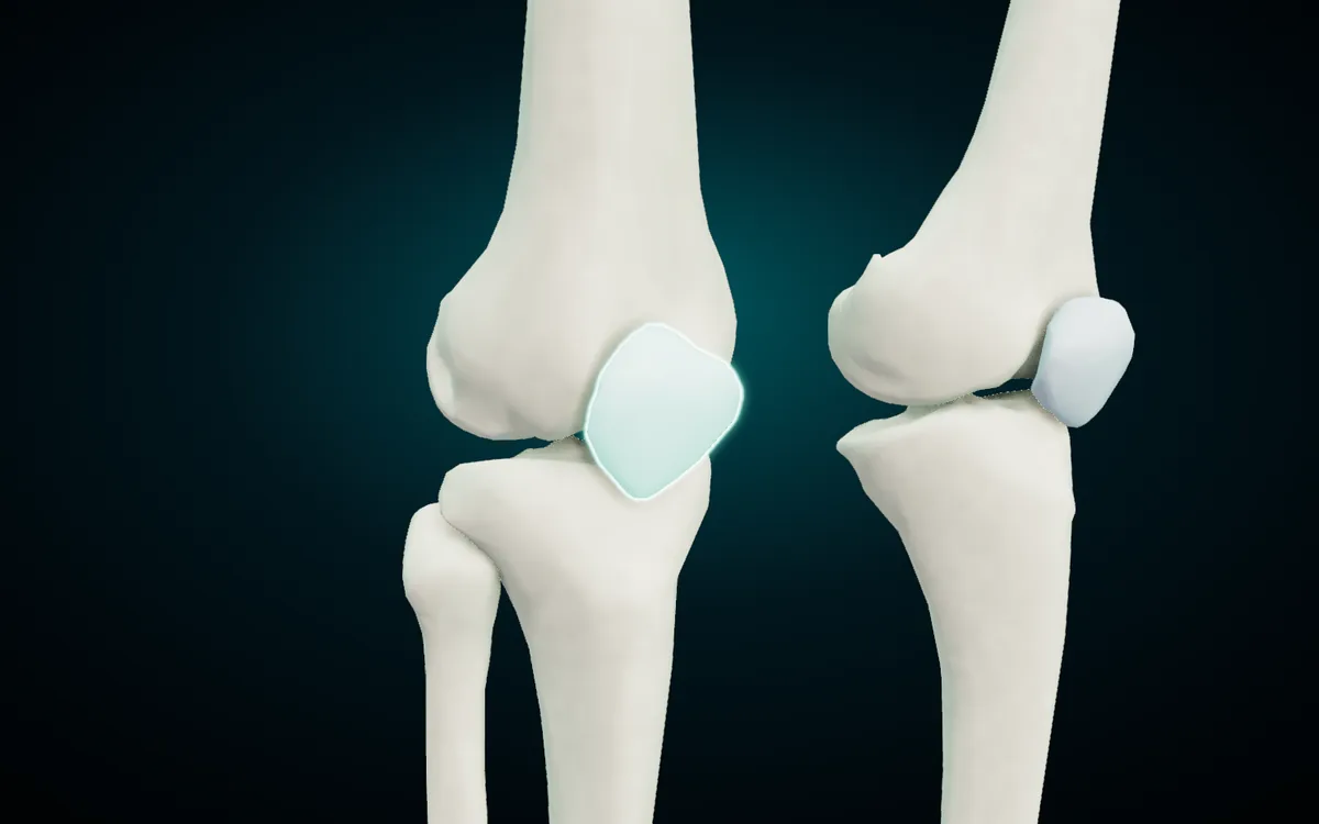 Both knees in the 3D atlas from the front and right, with the right patella highlighted: a flat, rounded bone in front of the lower end of the femur, above the tibia