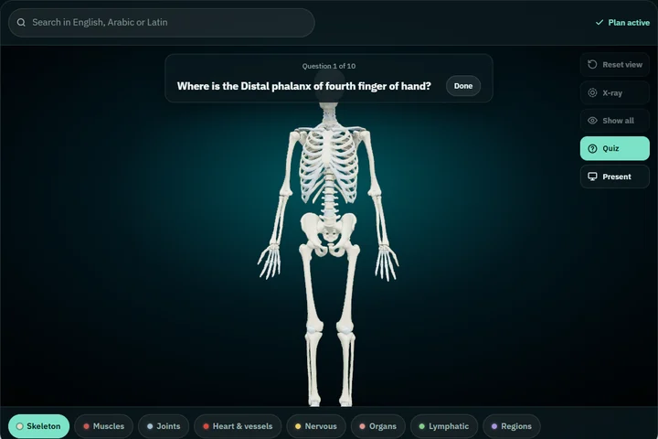 A quiz question asking where a structure is